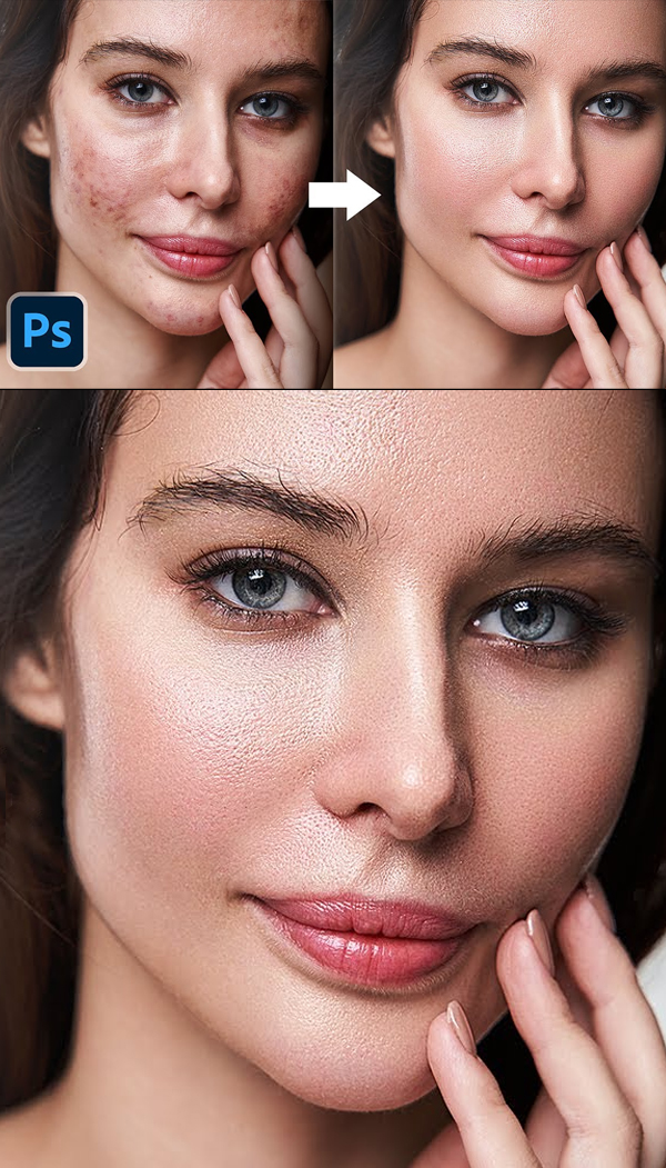 How to Auto-Repair Skin in Photoshop Tutorial